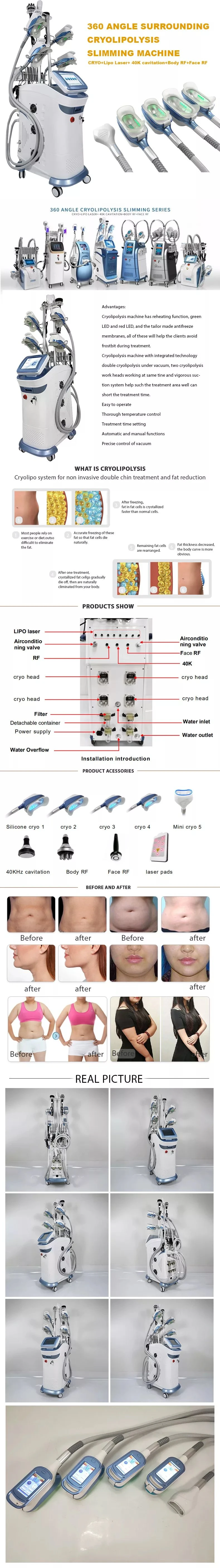 2023 Top Sales Super 360 Cryolipolysis Slimming Machine 360 Cryolipolysis Fat Freezing Machine with 40K Cavitation RF Lipolaser