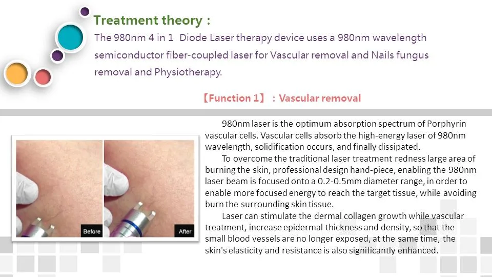 Black Technology Dermatology 980 Nm Laser Vascular Removal Machine Varicose Veins Treatment 980nm Diode Laser