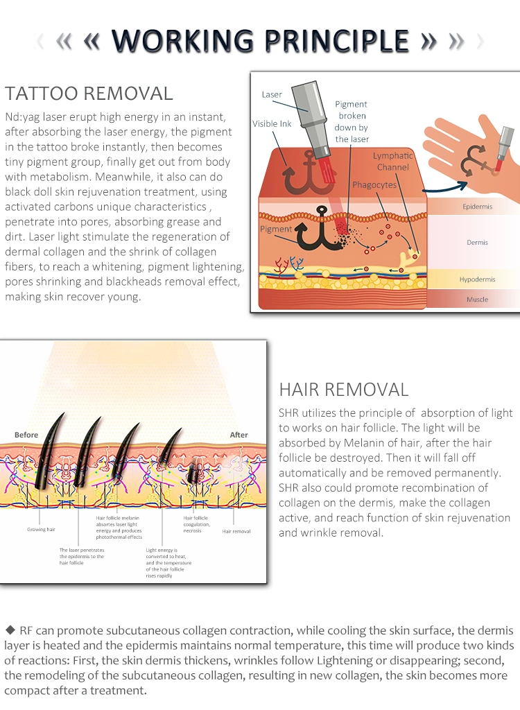 Medical CE Approved Factory /Opt/ IPL+Elight+ RF with Pigmentation Removal Device