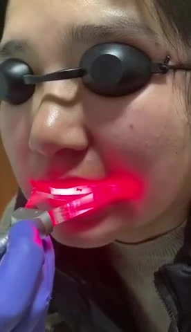 Máquina odontológica a laser de diodo 980nm aprovada pela CE para clareamento dental